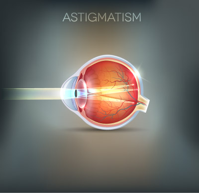 Advice on Astigmatism at Foley Opticians Wexford