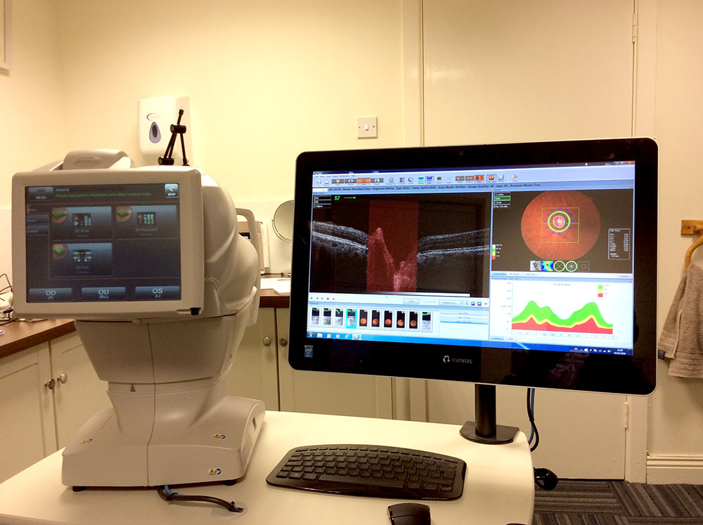 Automated Visual Field Testing, eye test, wexford
